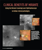 Clinical Benefits of Mirante image