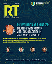 The Evolution of a Mindset: Treating Symptomatic Vitreous Opacities in Real-World Practice image