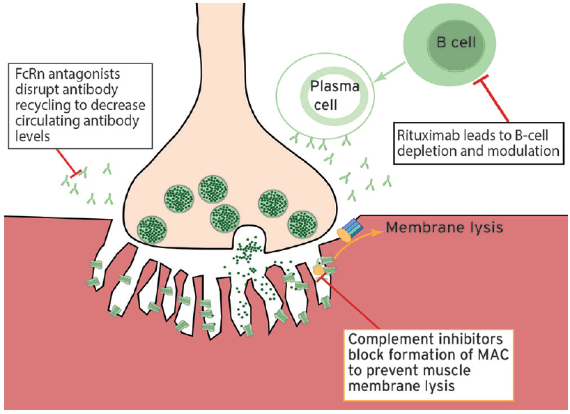 Neuromuscular Notes: Next Generation Treatments for ...