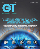 Targeting and Treating All Glaucoma Anatomy with Canaloplasty image