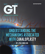 Understanding the Mechanisms Associated With Canaloplasty image