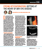 Eyeing Up Evaporation: Getting at the Heart of Dry Eye Disease image