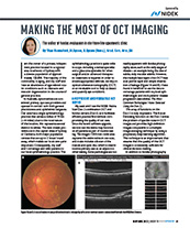 Making the Most of OCT Imaging image