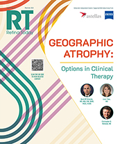 Geographic Atrophy: Options in Clinical Therapy image