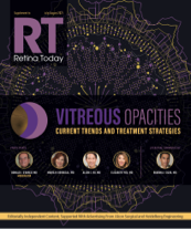 Vitreous Opacities image