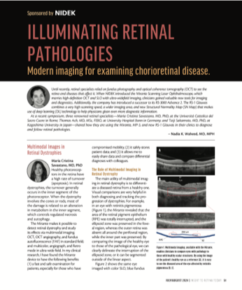 RT Illuminating Retinal Pathologies