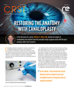 Restoring the Anatomy with Canaloplasty image