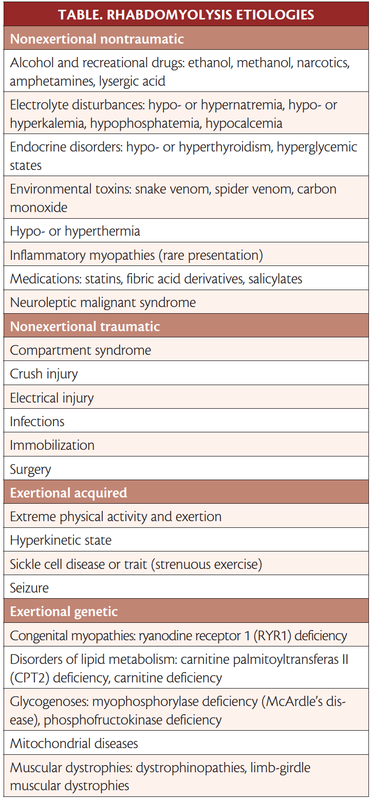 Neuromuscular Notes Rhabdomyolysis Practical Neurology