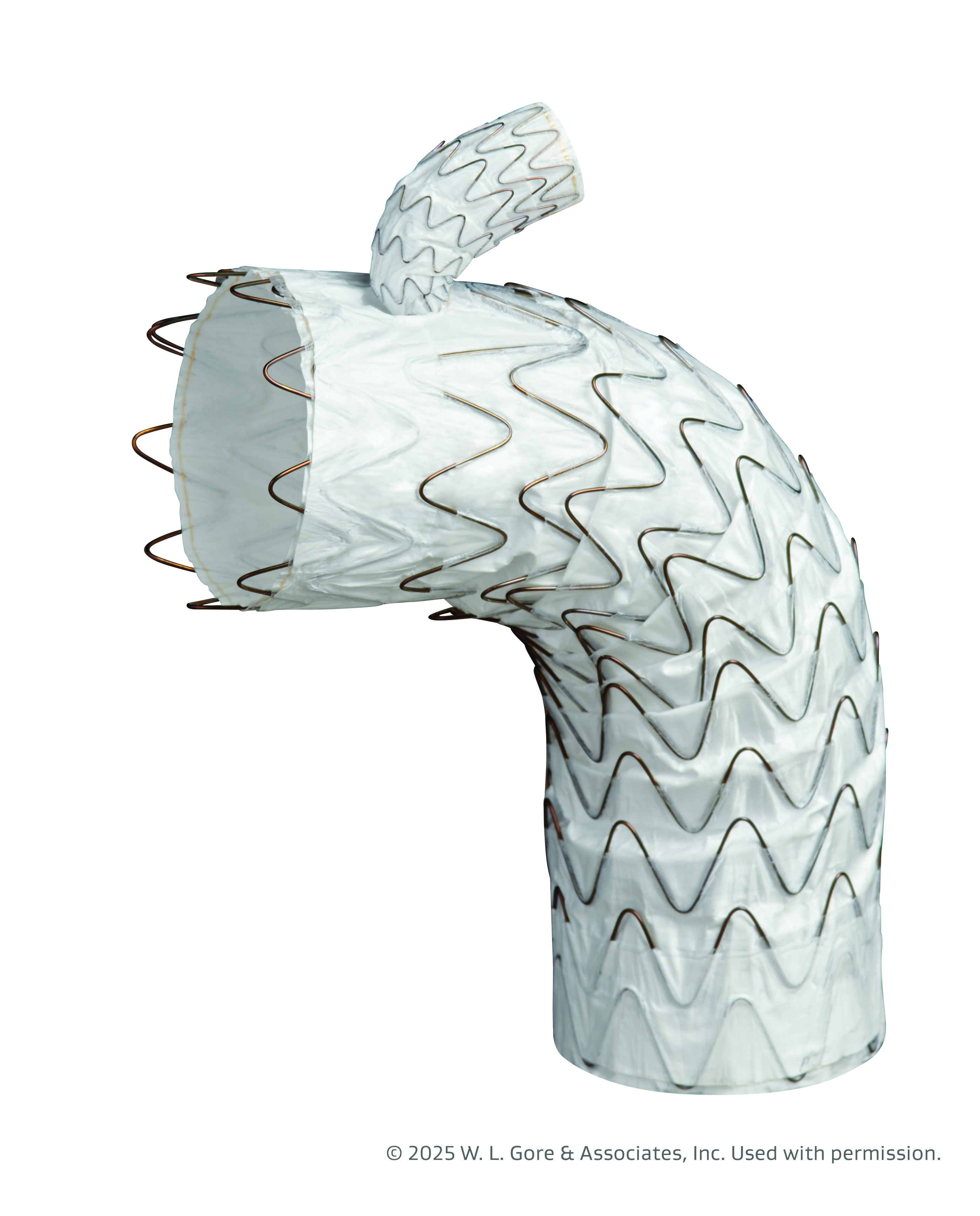 Gore TAG TBE Approved for Zones 0 and 1 Aortic Arch Repair