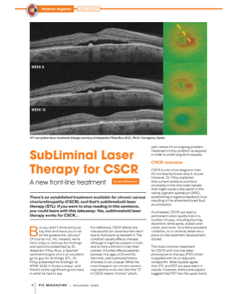 SubLiminal Laser Therapy for CSCR image