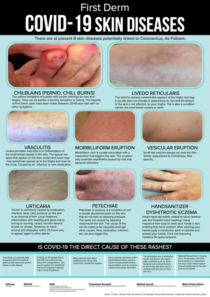 New Infographic Compares Rashes to COVID Toes - Practical Dermatology