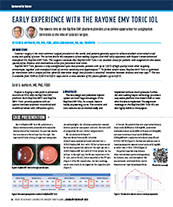 Early Experience With the RayOne EMV Toric IOL image