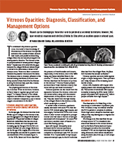 Vitreous Opacities: Diagnosis, Classification, and
Management Options image