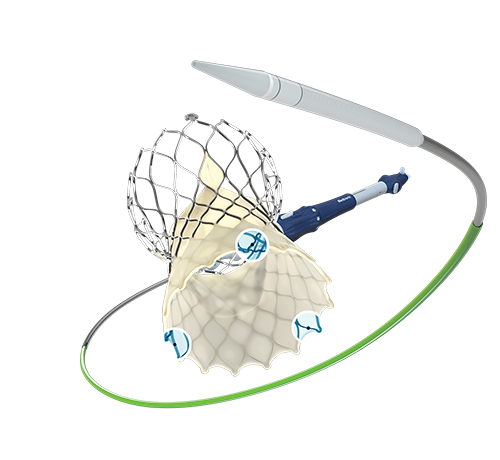 Medtronic’s Evolut FX+ TAVR System Approved in Europe - Cardiac ...