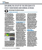 Exploring The Utility Of The
OPD-Scan III To Detect Keratoconus And Corneal Ectasias image