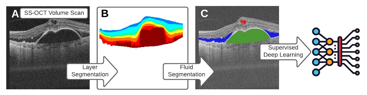 Retina Specialist - Why should I see one? - SK Retina, retina