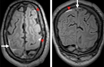 Case Reports - Practical Neurology