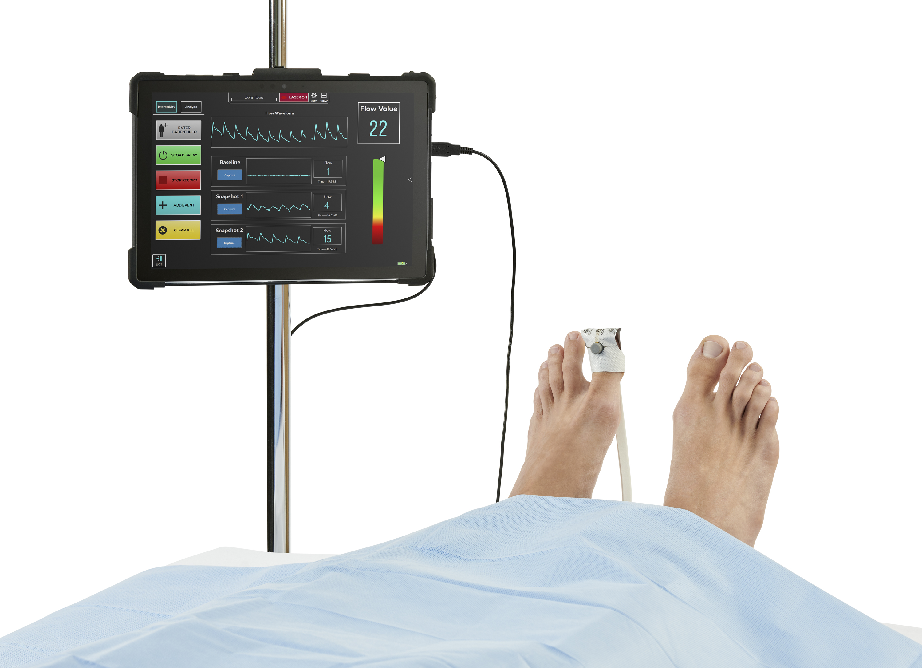 Medtronic’s FlowMet Peripheral Blood Flow Monitoring System With a