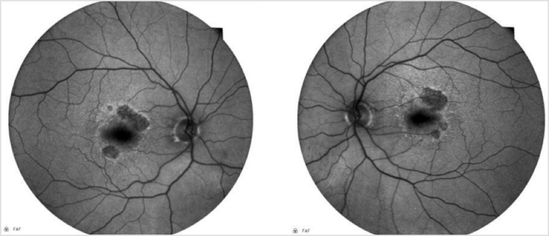 GA Case Compendium: The Optometrist as Advocate for the Patient with ...