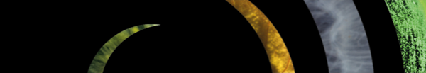 glaukos header 10-23