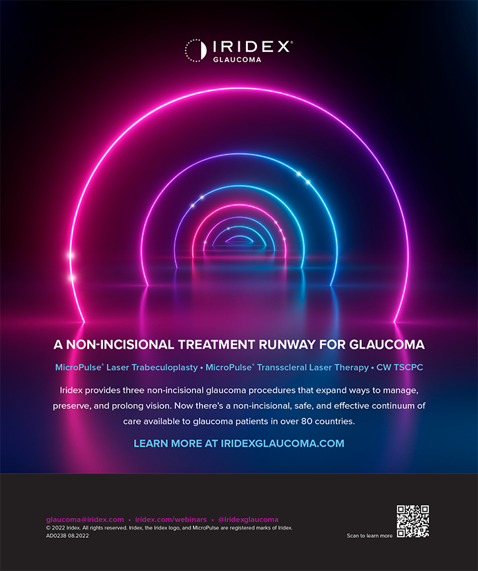 incidental-glaucoma-screening-using-teleophthalmology-at-a-tertiary