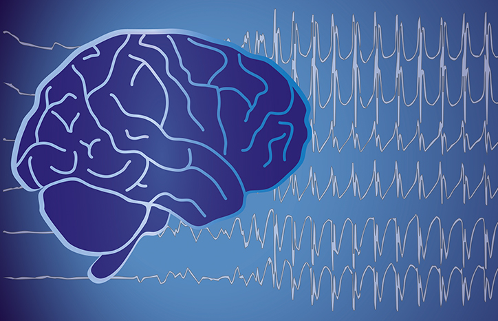 Epilepsy & Seizures - Practical Neurology