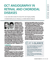 OCT ANgiography in Retinal