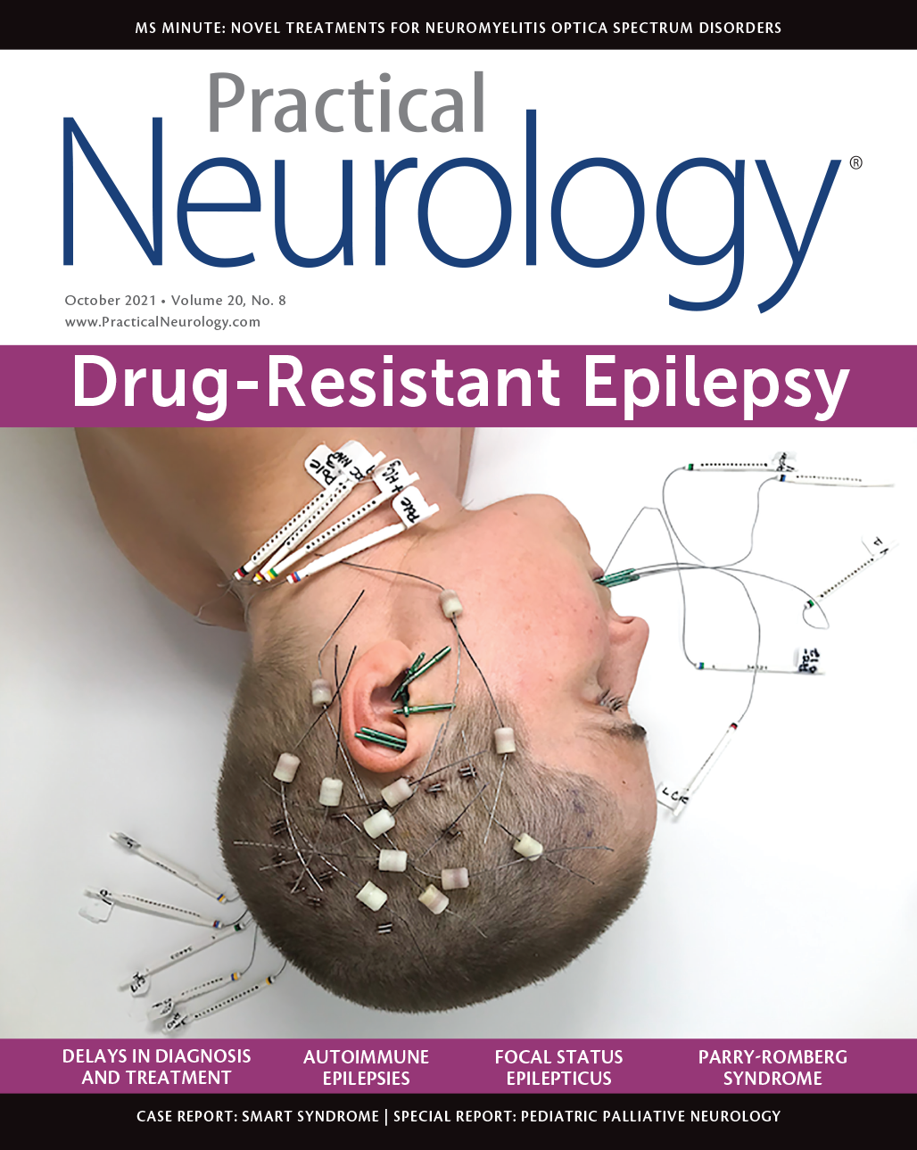 Focal Status Epilepticus 9 Years After Brain Abscess - Practical Neurology