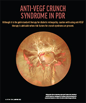 Anti-VEGF Crunch Syndrome in PDR image