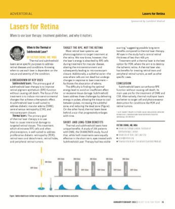 Lasers for Retina image