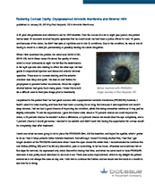 Restoring Corneal Clarity