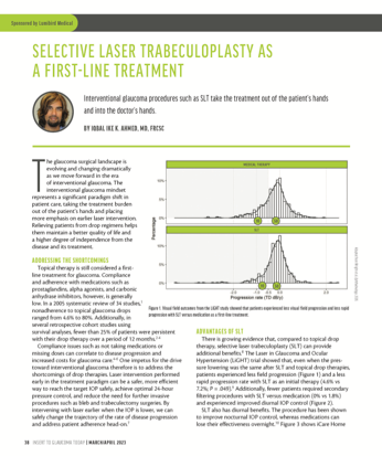 Selective Laser Trabeculoplasty as a First-line Treatment image