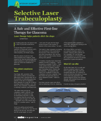 A Safe and Effective First-line - Therapy for Glaucoma image