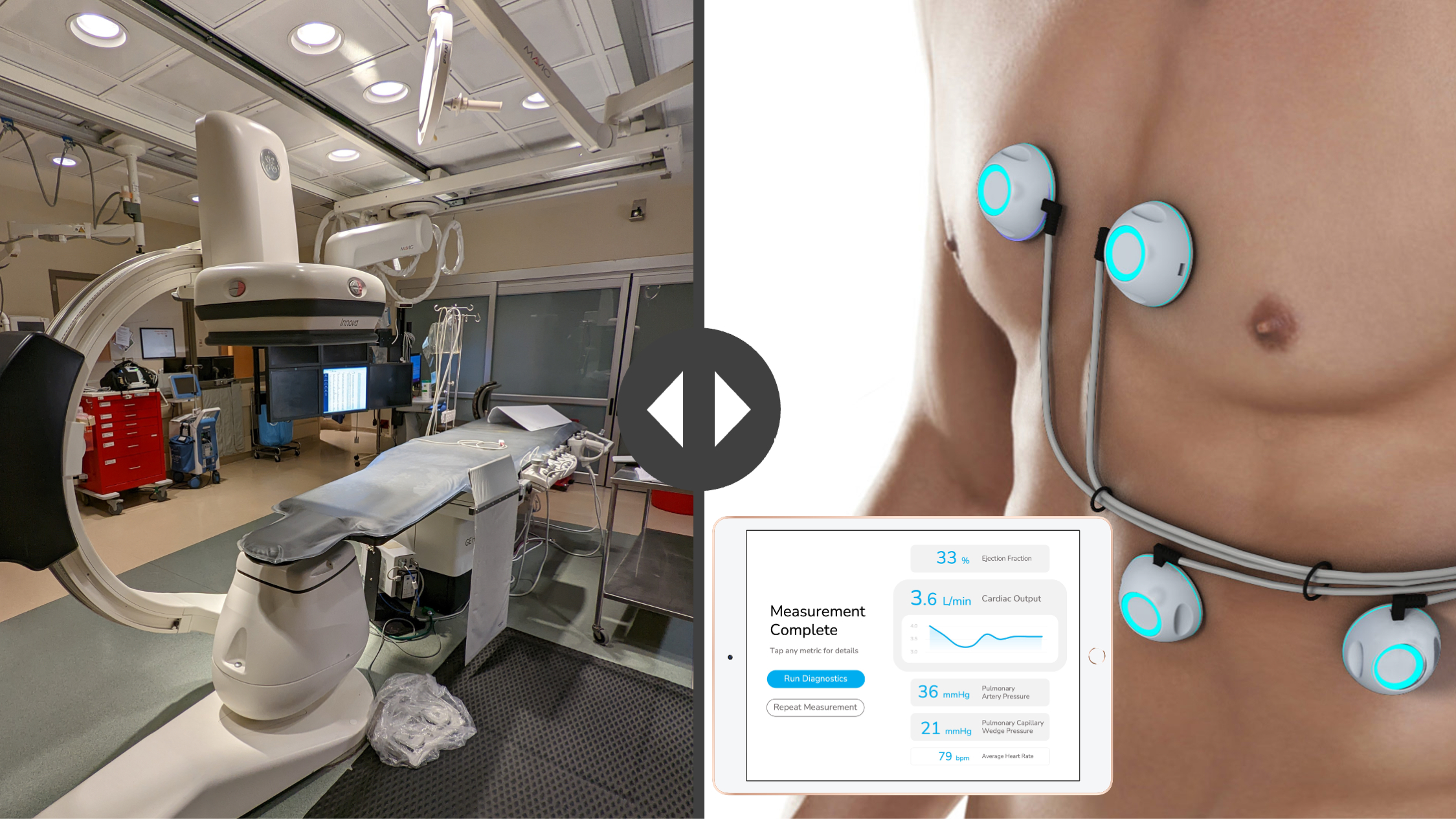 Sensydia's Cardiac Performance System Studied to Develop Pulmonary