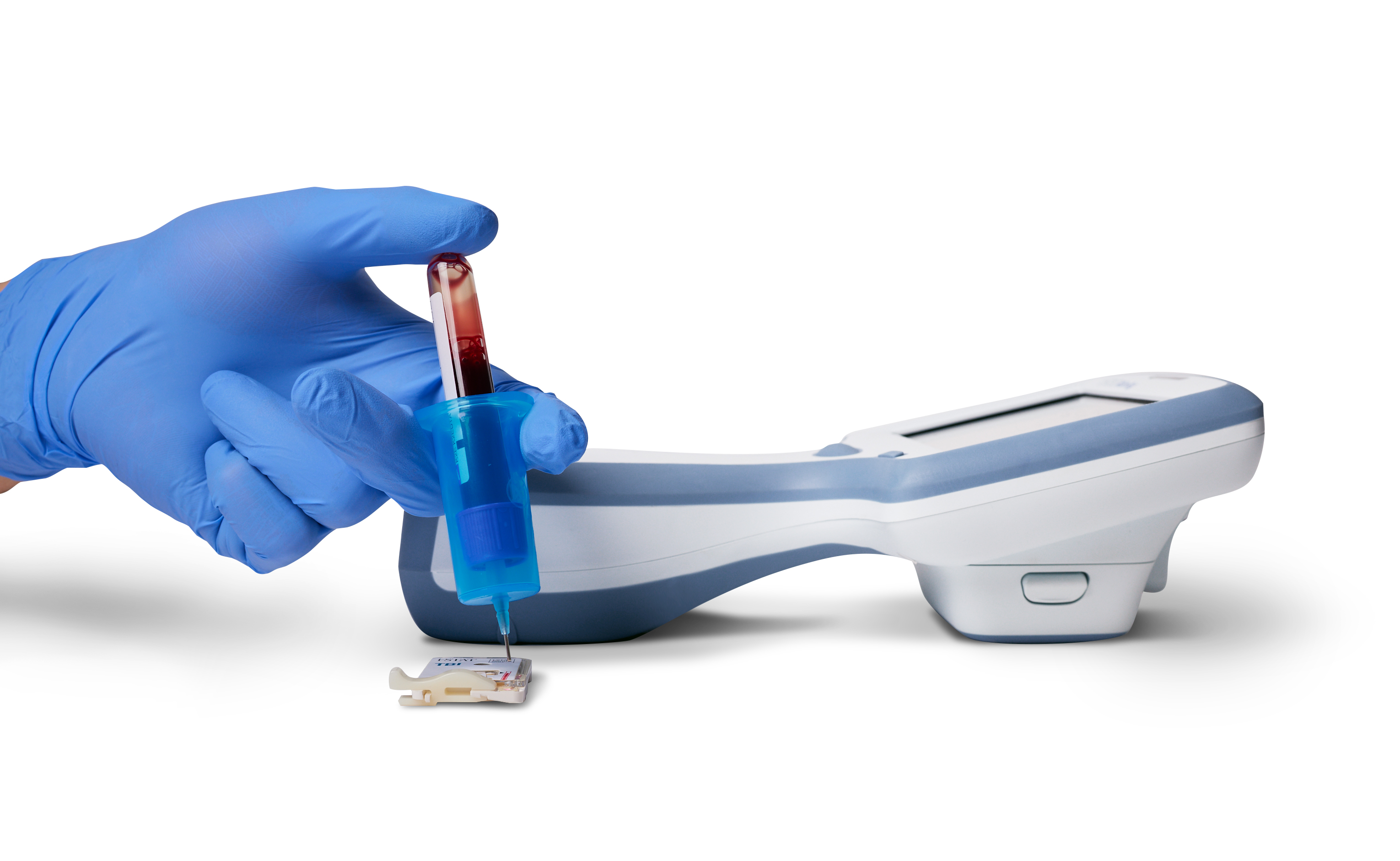 Abbott’s Portable Whole Blood Test for TBI Cleared by FDA - Practical ...