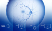 Zeiss Retina Workflow Link