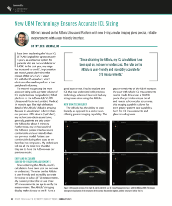 New UBM Technology Ensures Accurate ICL Sizing image