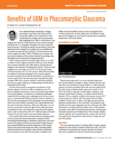 Benefits of UBM