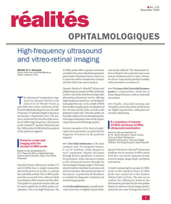High-frequency ultrasound and vitreo-retinal imaging image