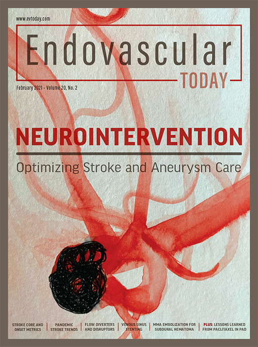 Neurointervention Endovascular Today