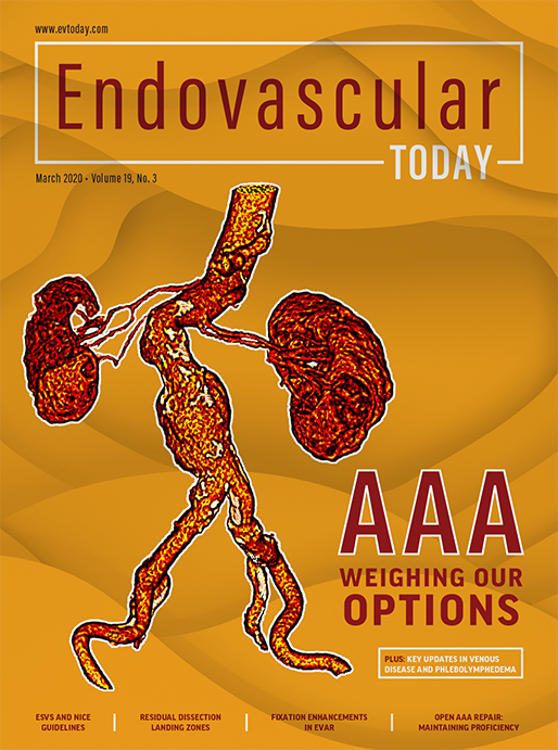 EVAR - Endovascular Today