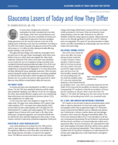 Glaucoma Lasers