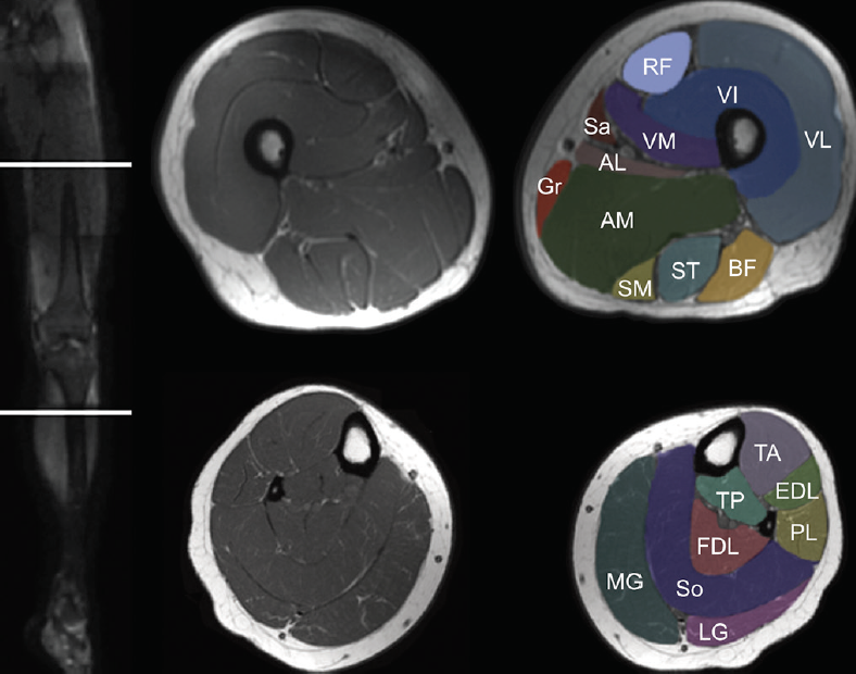 Knee Muscle Anatomy Mri : Atlas Of Knee Mri Anatomy W ...