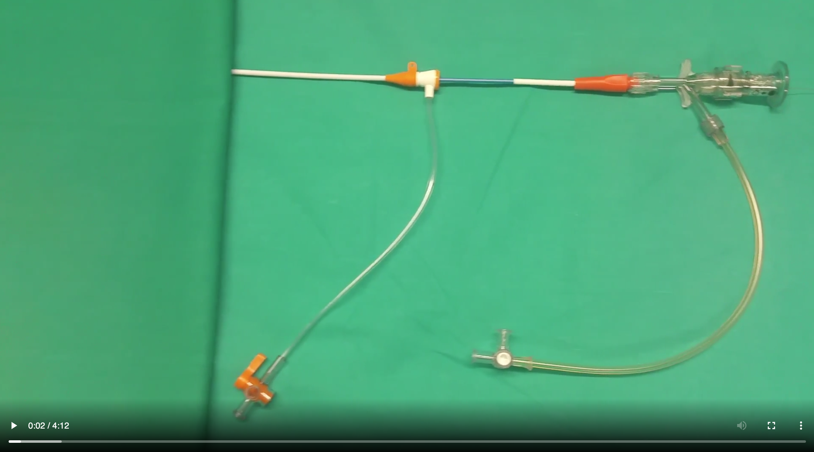 Using Coils to Treat a Coronary Perforation Cardiac Interventions Today