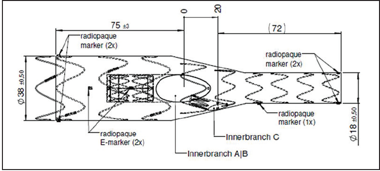 Making the Revolutionary Routine - Endovascular Today