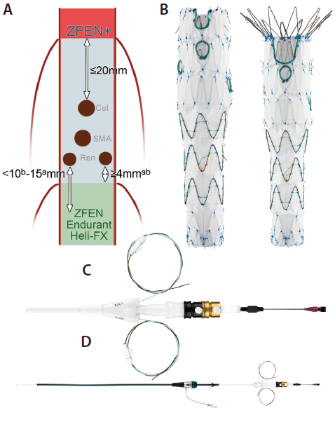 Modern Complex Stent Graft Designs: A Closer Look - Endovascular Today