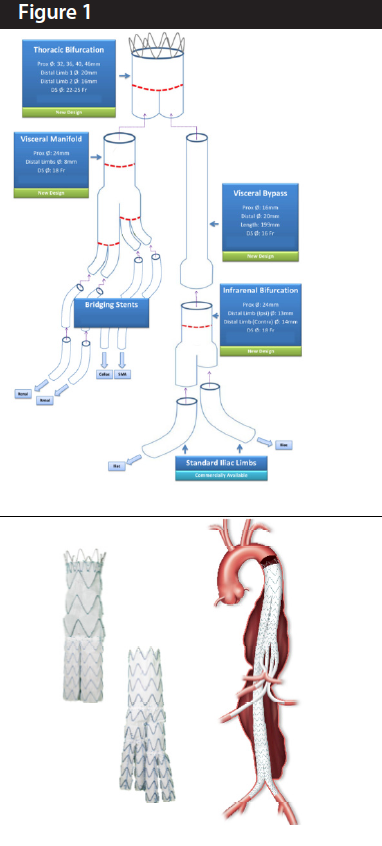 Modern Complex Stent Graft Designs: A Closer Look - Endovascular Today