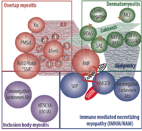 Inflammatory Myopathies - Practical Neurology