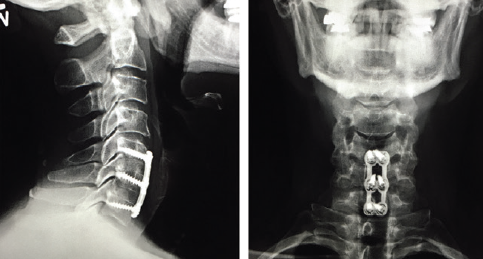 Ergonomics in the Clinic and OR - Glaucoma Today