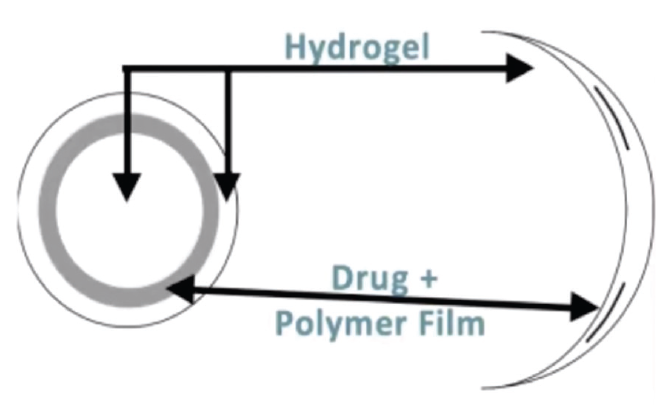 The Future of Drug Delivery - Glaucoma Today